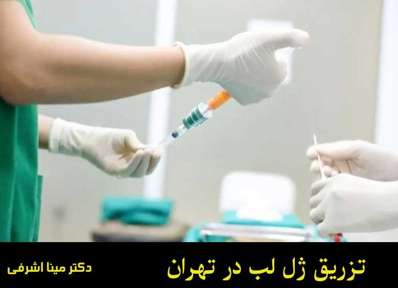 تزریق ژل لب در تهران